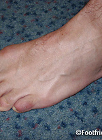 Khu solo by Foot Friends