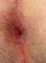Ryan shows his ass hole by Squirtz