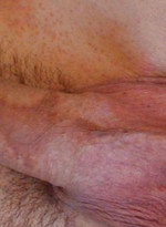 Emo Skater Twink With Uncut Cock and Big Balls by Alternadudes