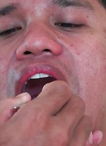 Dr. Argie Gayvara is explaining how the sperm is generated inside the testicles to his ailing Asian twink patient Alex by Dr. Twink